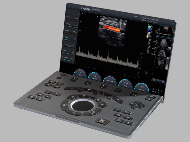 Ultrasonido SonoAir 30