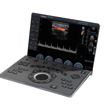 Equipo de Ultrasonido Portátil SonoAir 30