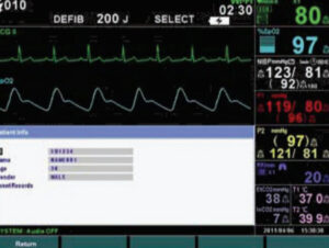 Disponible multiples opciones de monitorización, 3/5/12 derivaciones de ECG (Glasgow University), SpO2 Mediana o Nellcor, PNI Omron, PI, Temperatura y Respironics EtCO2.